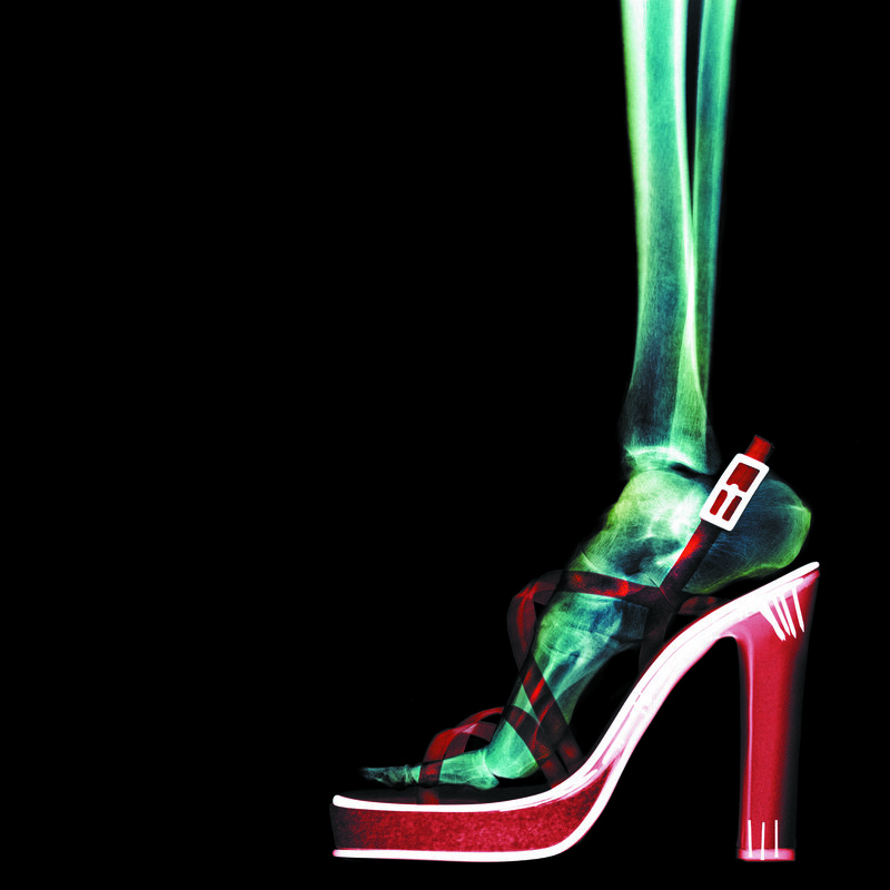 X-ray of foot in high heels