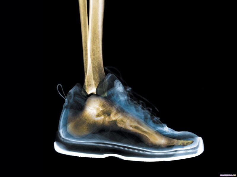 X-ray of foot in sneaker