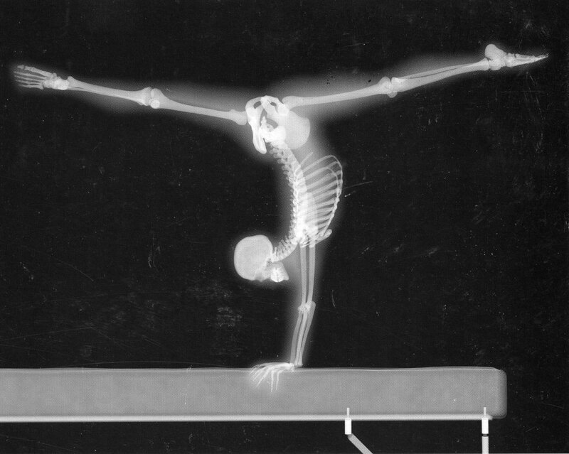 X-ray of gymnast on beam