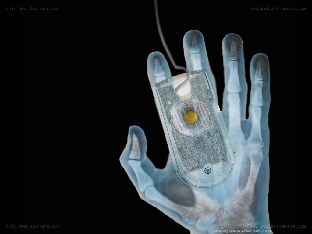 X-ray of hand holding computer mouse