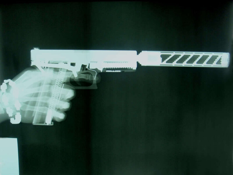 X-ray of hand holding gun
