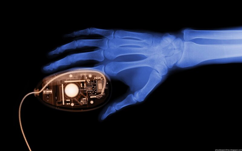 X-ray of hand holding mouse