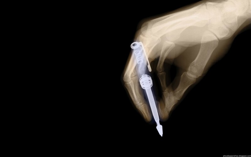 X-ray of hand holding pen