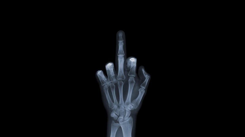 X-ray of hand making middle finger gesture