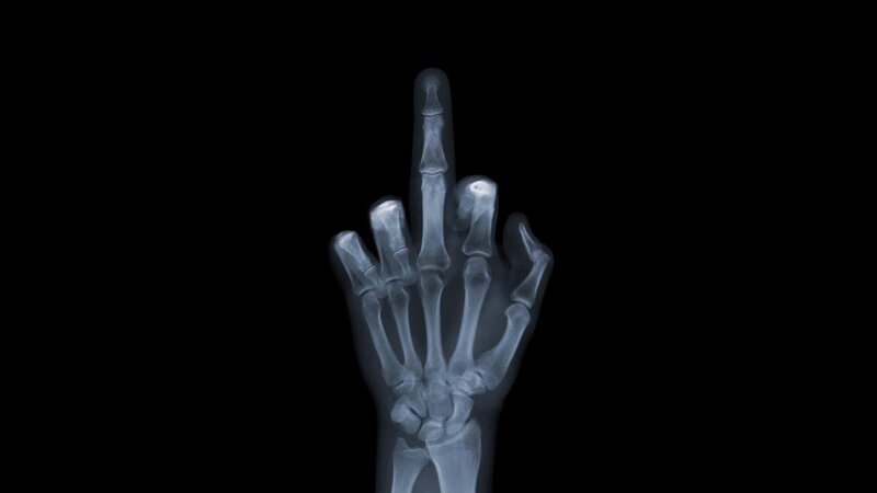 X-ray of hand making middle finger gesture