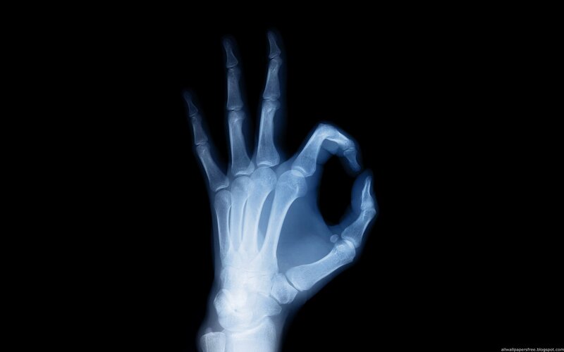 X-ray of hand making okay gesture