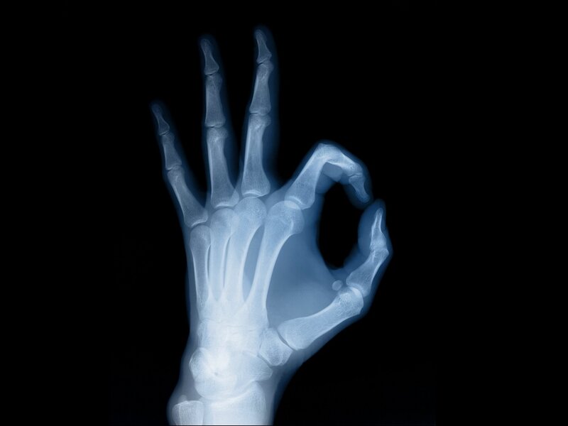 X-ray of hand making okay gesture