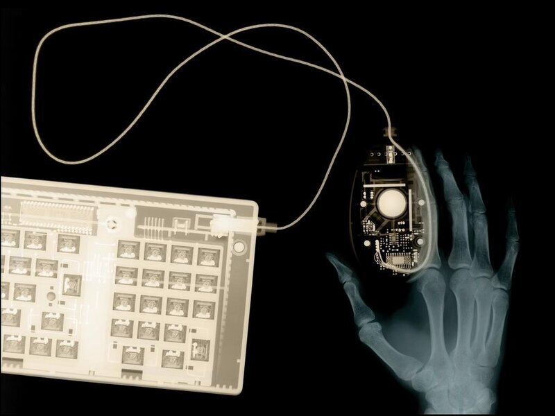 X-ray of hand with keyboard and mouse