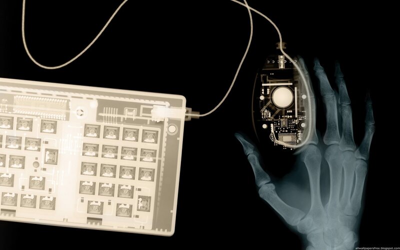X-ray of hand with keyboard and mouse