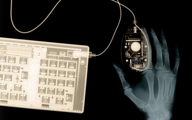 X-ray of Hand with Keyboard