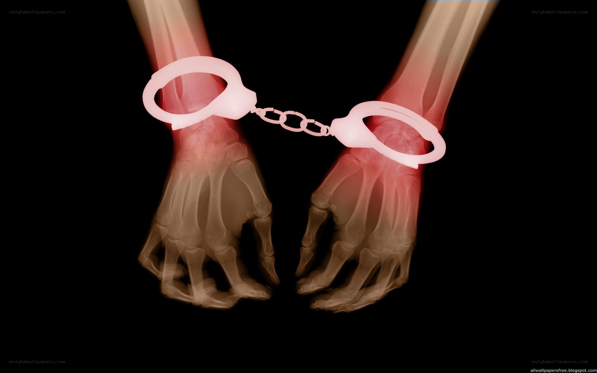 X-ray of handcuffed hands