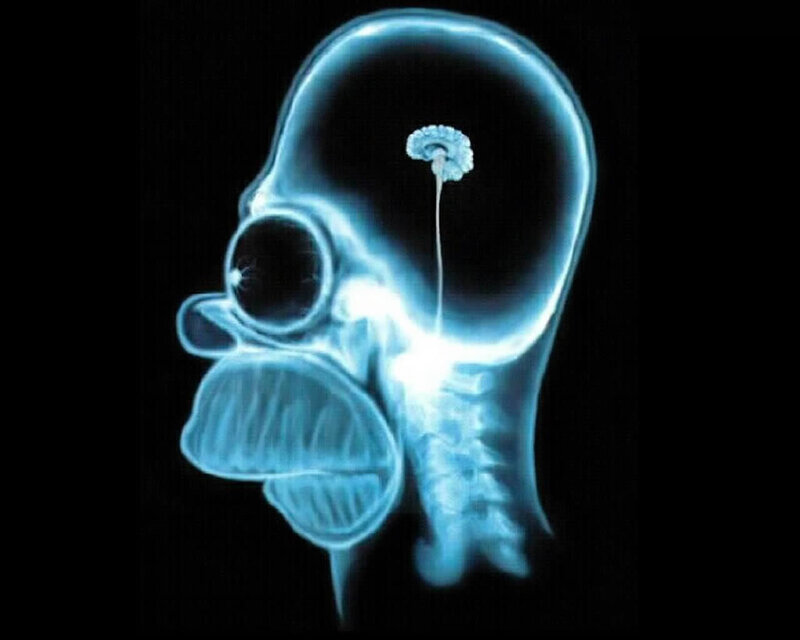 X-ray of Homer Simpson