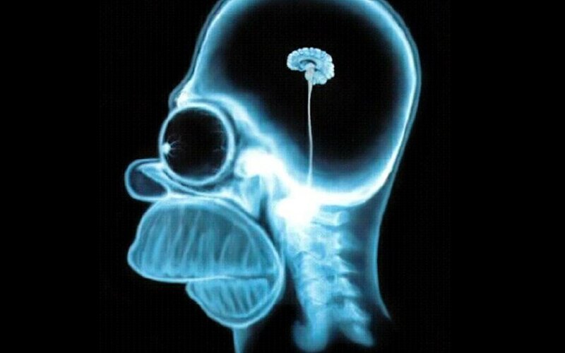 X-ray of Homer Simpson