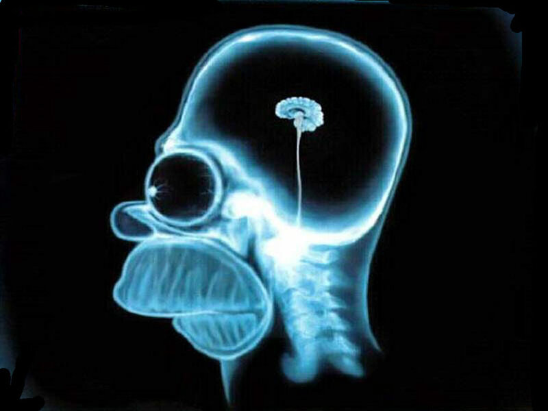 X-ray of Homer Simpson