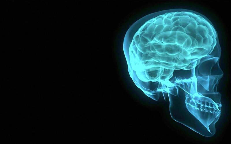 X-ray of human brain and skull