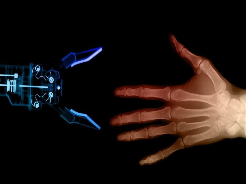 X-ray of human hand and robotic arm