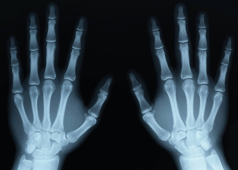 X-ray of human hands