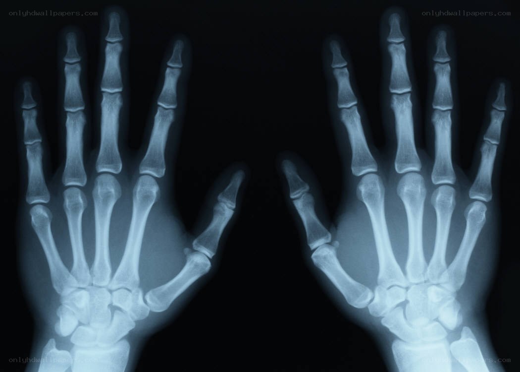 X-ray of human hands