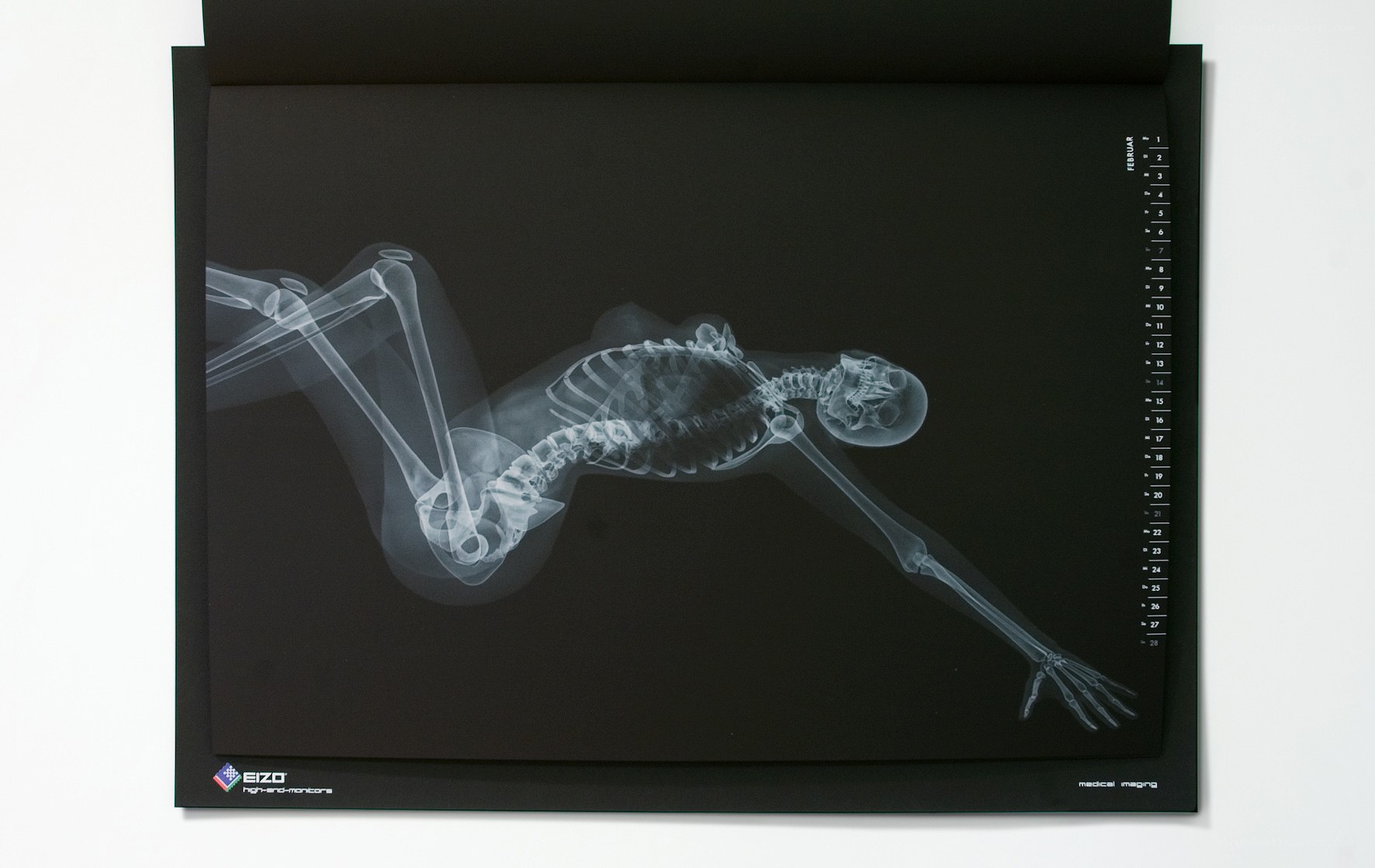 X-ray of human skeleton