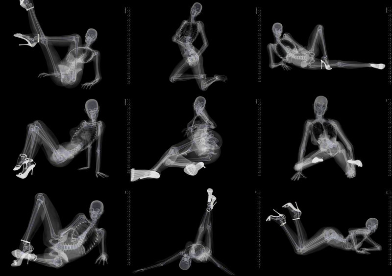 X-ray of human skeletons in poses