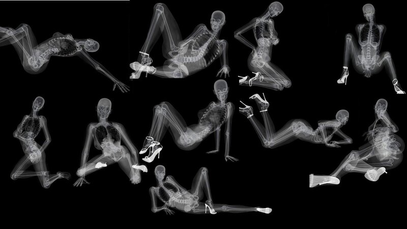 X-ray of human skeletons in poses