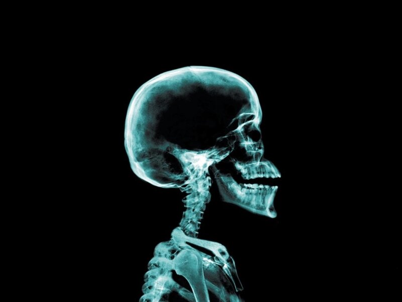 X-ray of human skull and neck