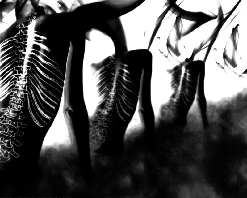 X-ray of skeletal figures