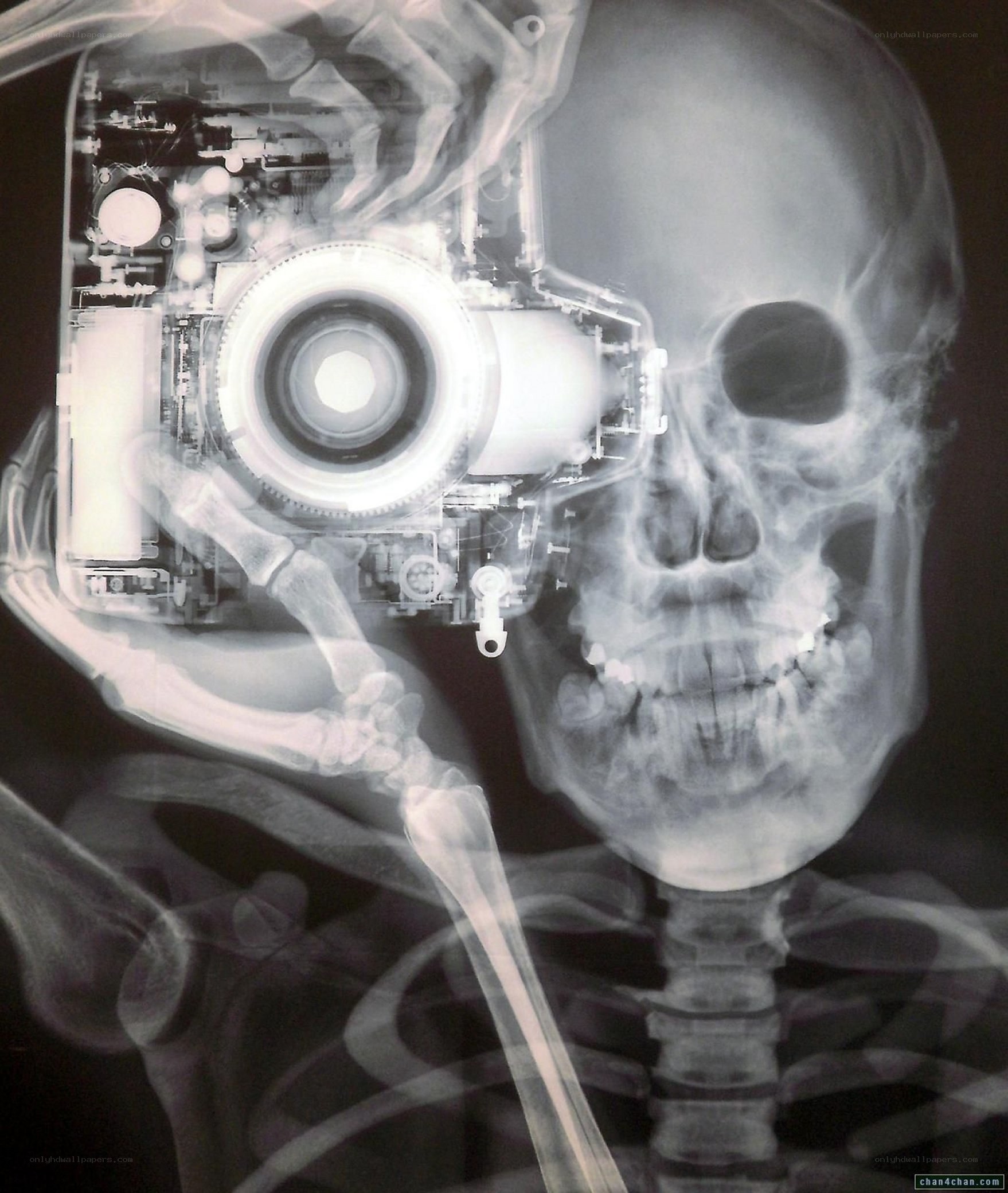X-ray of skeleton holding camera