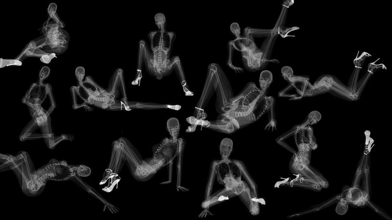 X-ray of skeletons in poses