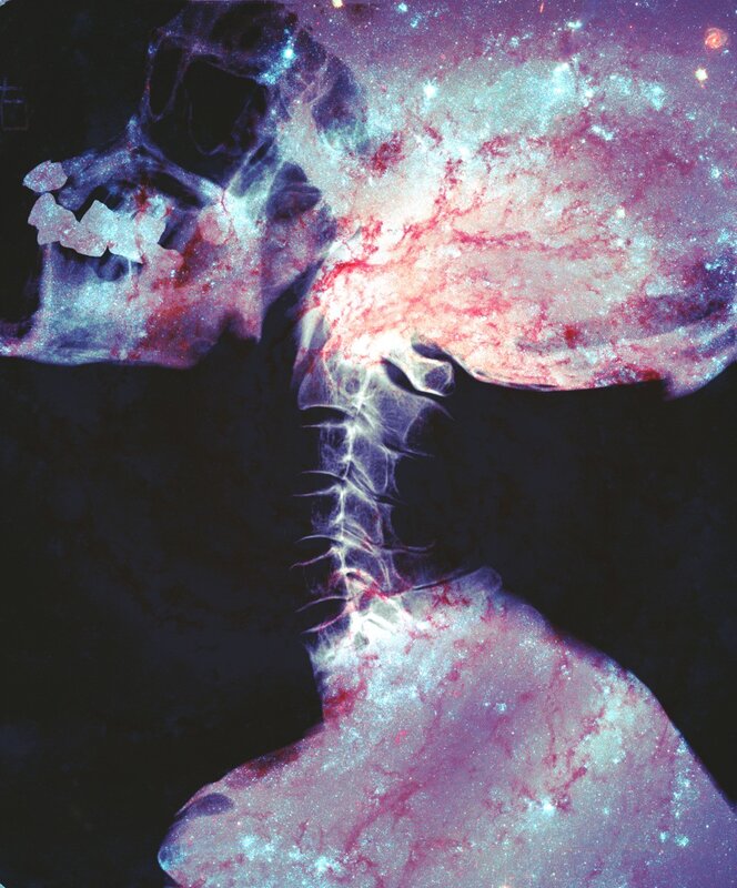 X-ray of skull with galaxy overlay