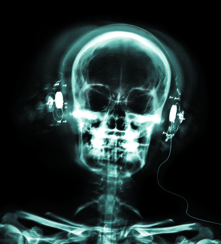 X-ray of skull with headphones
