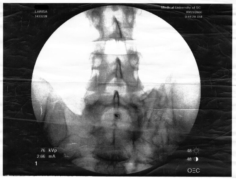 X-ray of spine and pelvis