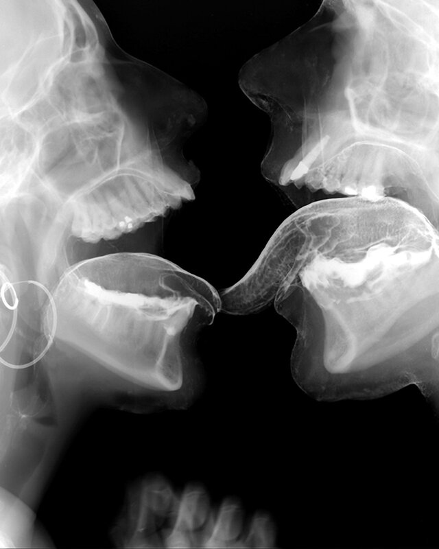 X-ray of two people kissing