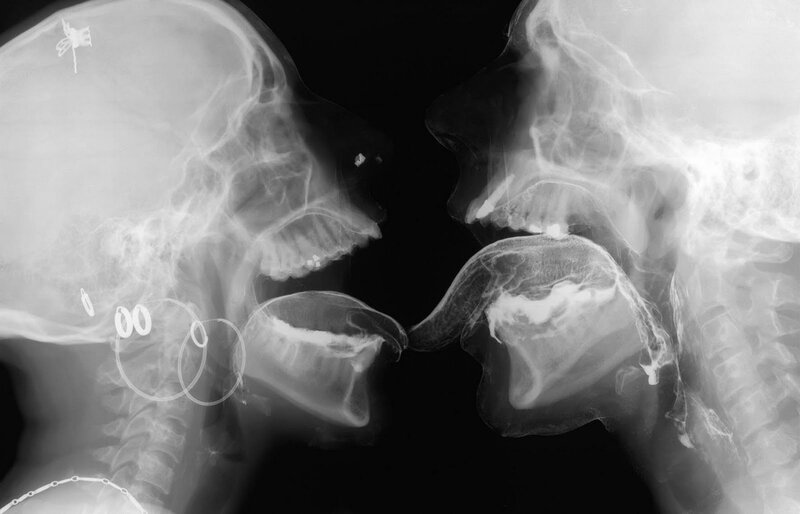 X-ray of two people kissing