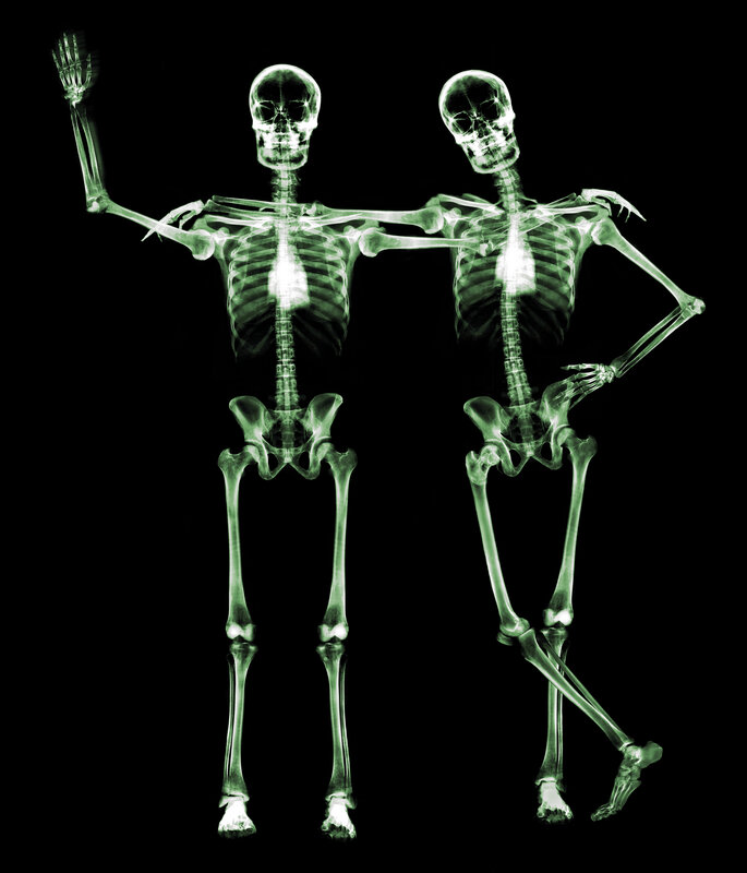 X-ray of two skeletons dancing