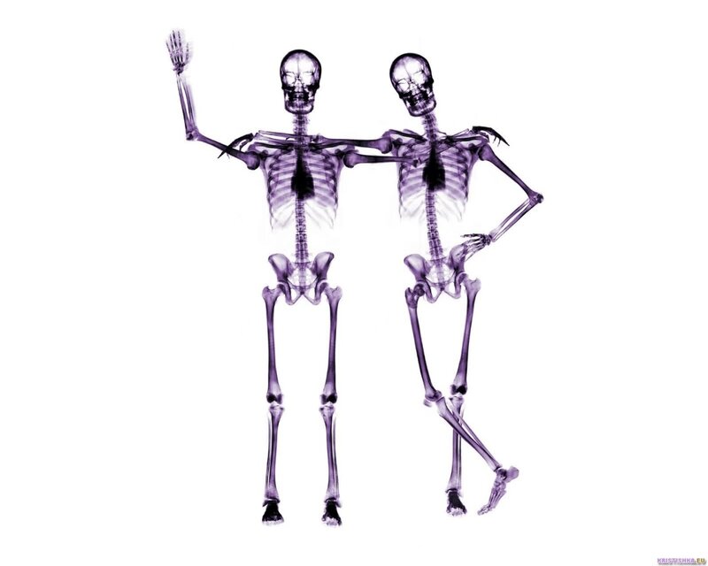 X-ray skeletons dancing