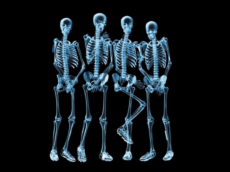 X-ray skeletons in a line