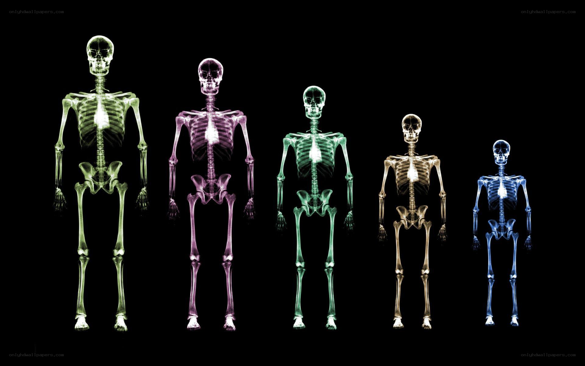 X-ray skeletons in a row