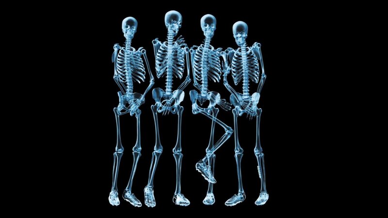 X-ray skeletons in a row