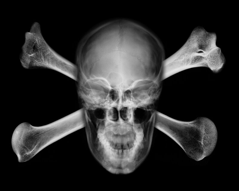 X-ray skull and crossbones