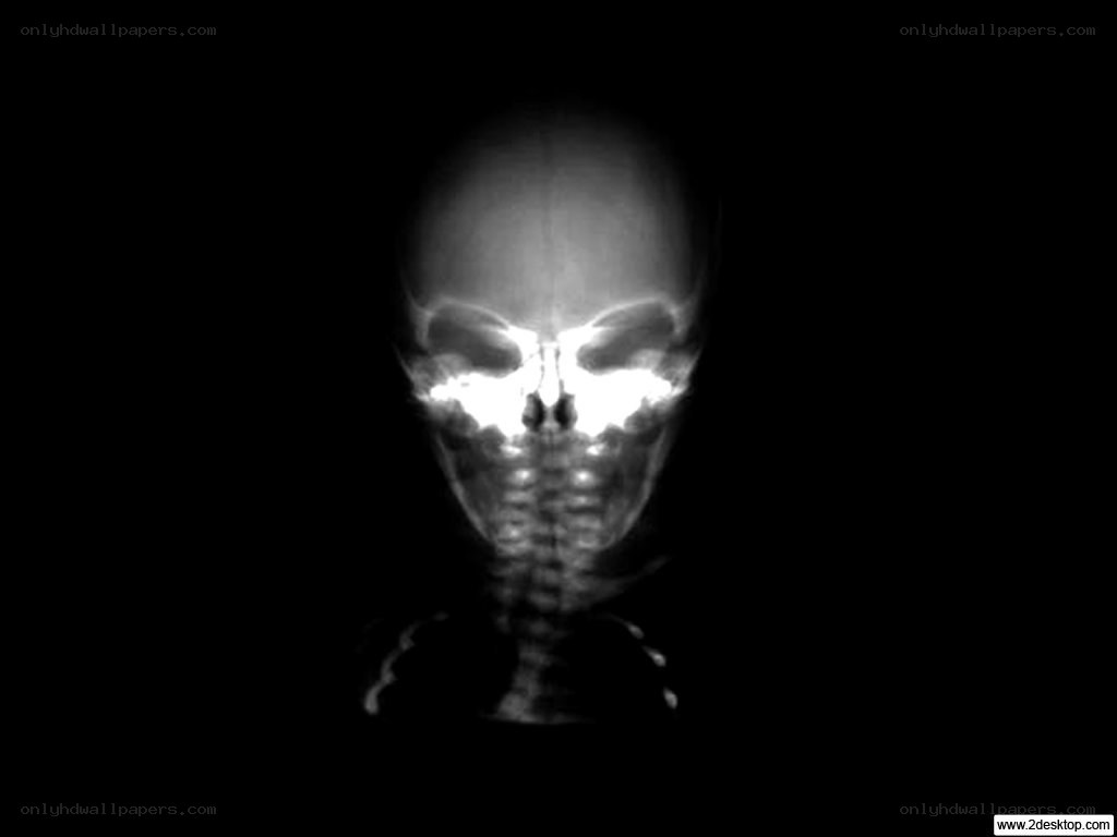 X-ray skull image