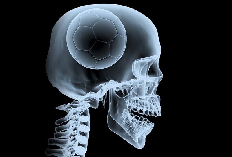 X-ray Skull with Soccer Ball