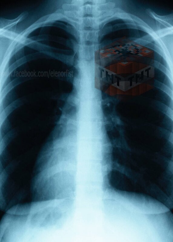 X-ray with Minecraft TNT