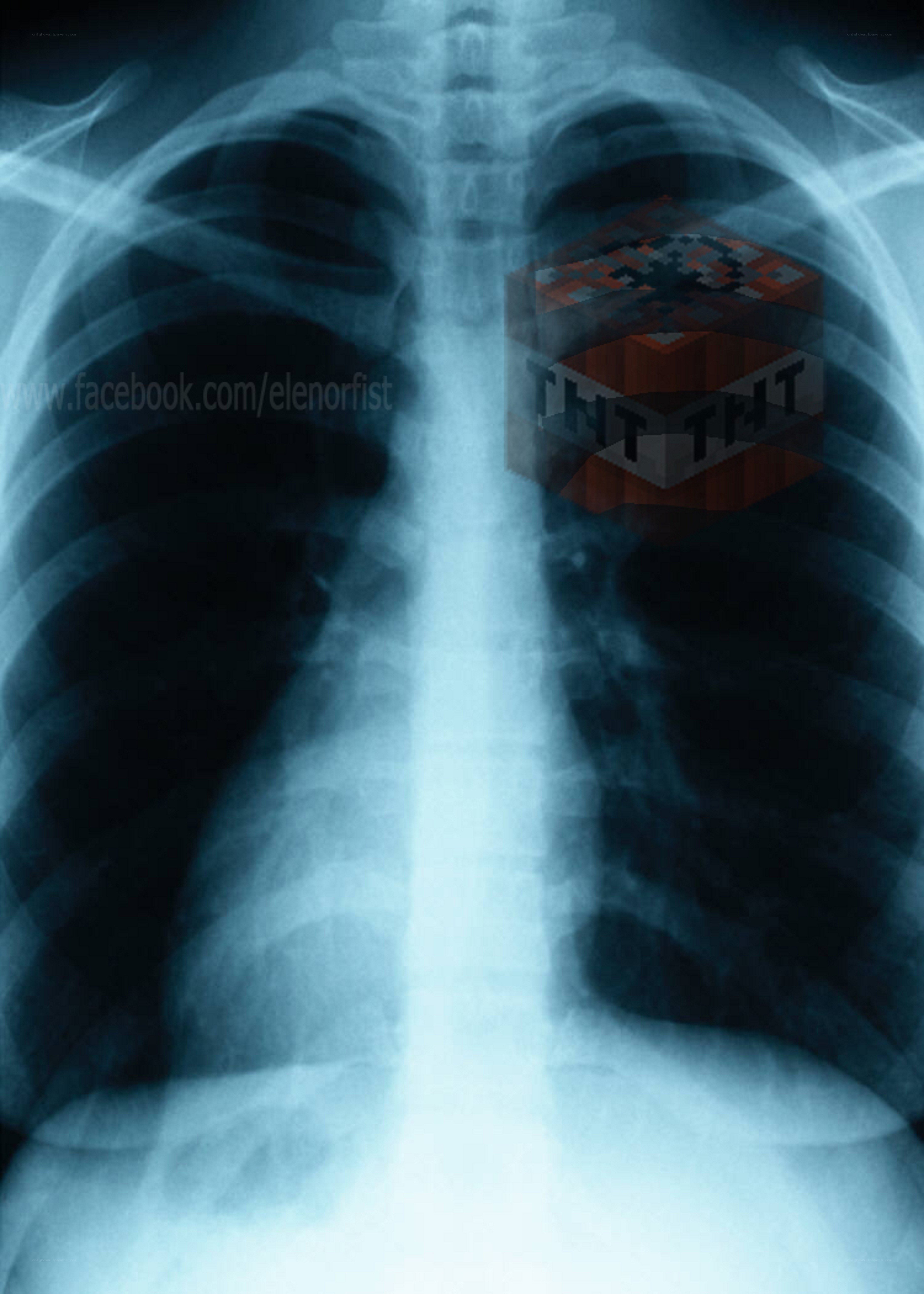 X-ray with Minecraft TNT