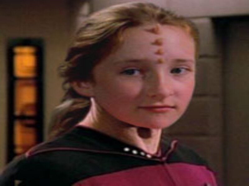 Young Girl with Forehead Markings