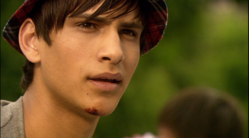 young man with blood on chin