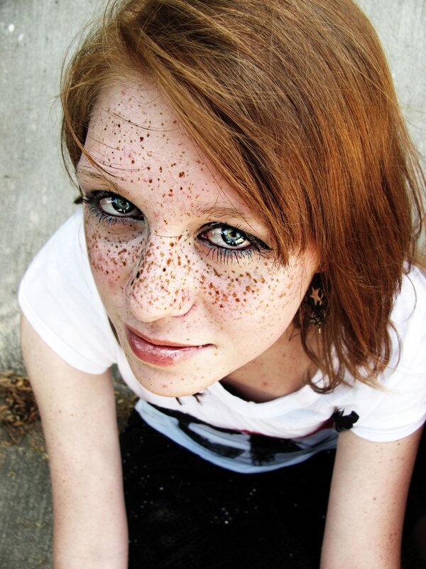 young woman with freckles