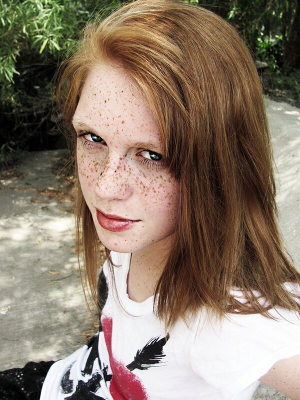young woman with freckles