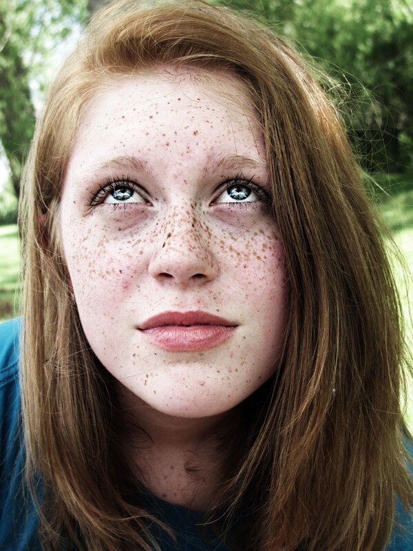 young woman with freckles